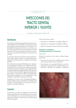 infecciones del tracto genital inferior i: vulvitis