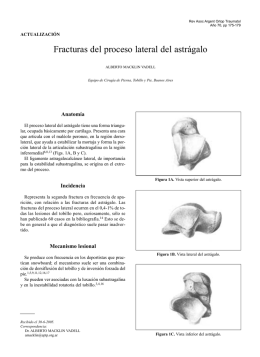 Fracturas del proceso lateral del astrágalo