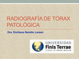 Rx Tórax patológica - Universidad Finis Terrae