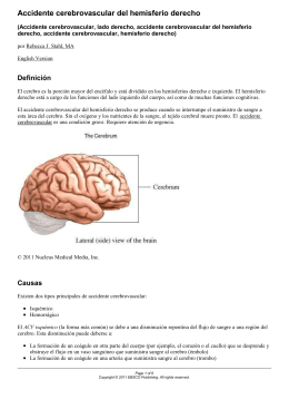Accidente cerebrovascular del hemisferio derecho