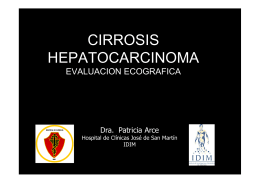 CIRROSIS HEPATOCARCINOMA