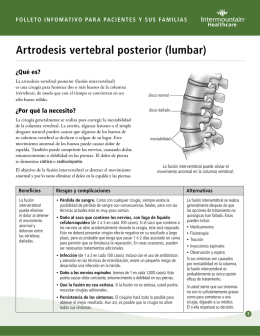 Artrodesis vertebral posterior (lumbar)