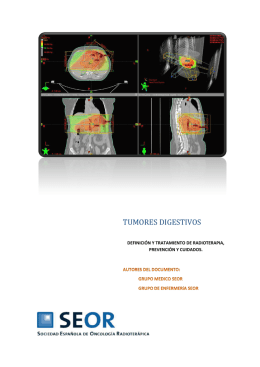tumores digestivos