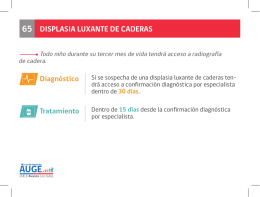 DISPLASIA LUXANTE DE CADERAS